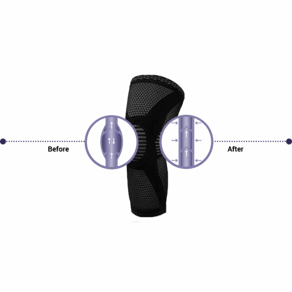 Konpresio Knee Sleeves Benefits